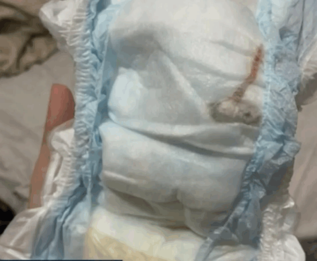image-2-1024x845 Mãe encontra rato morto na fralda de bebê