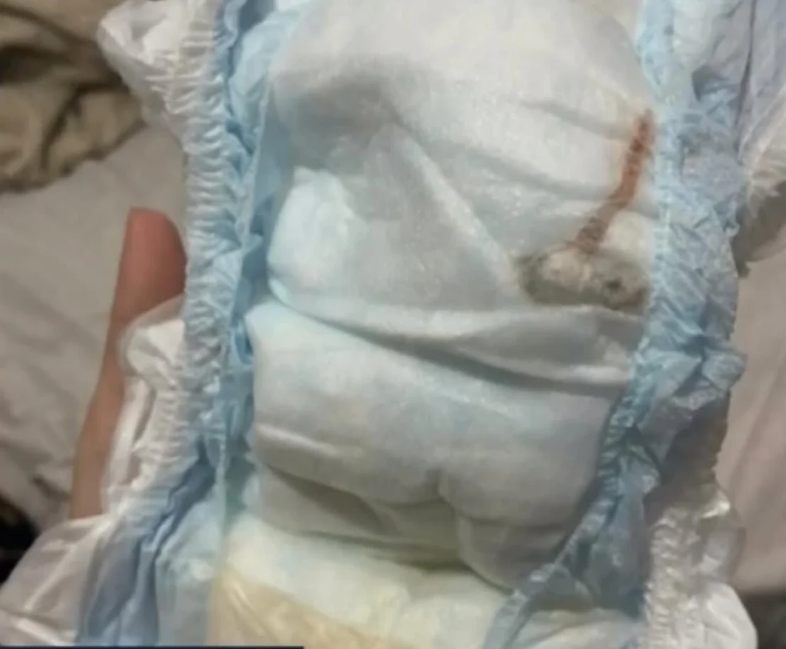 Mãe encontra rato morto na fralda de bebê